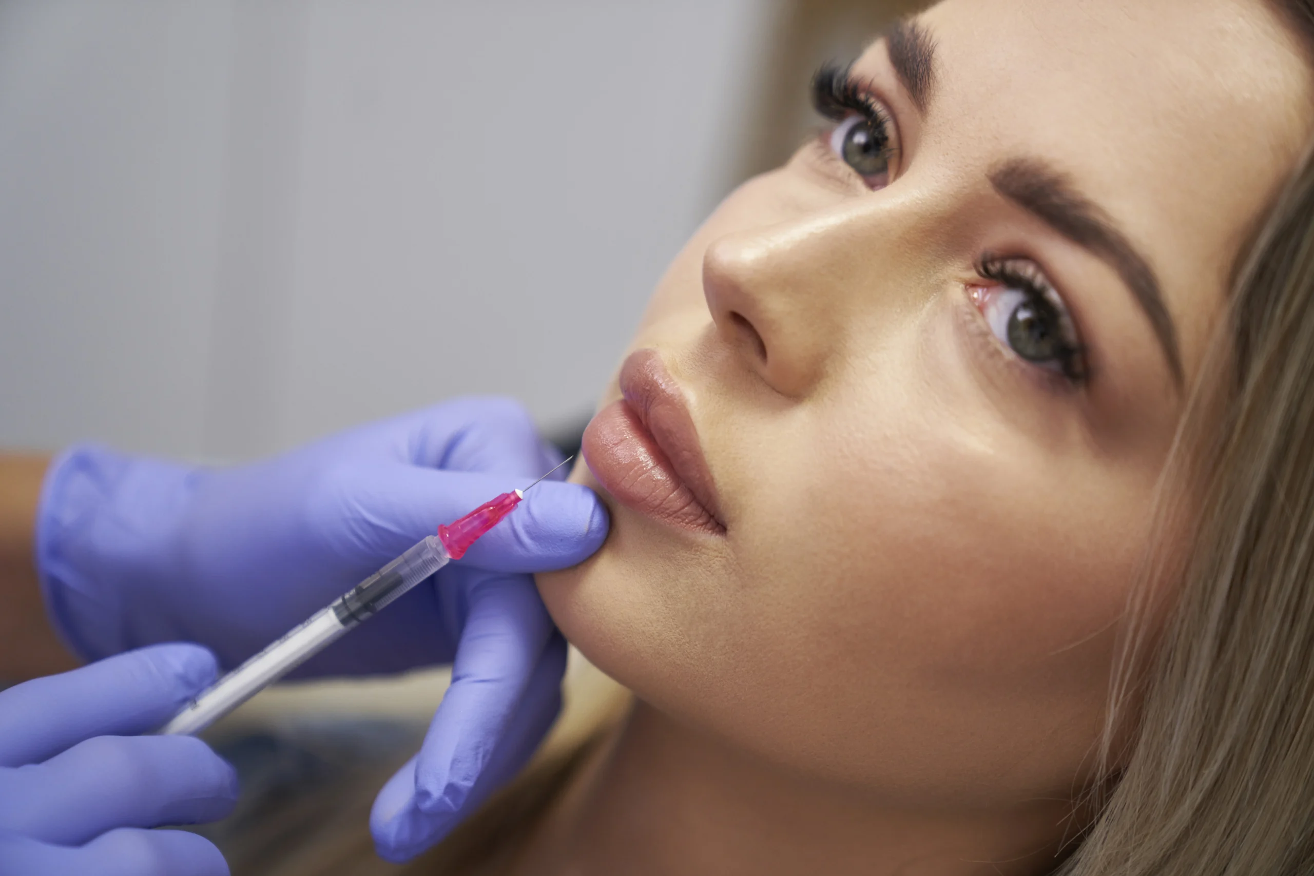 Botox Lip Flip vs. Lip Filler
